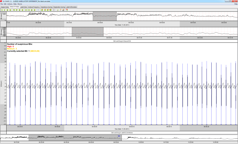 ECG signals displayed in VU-DAMS analysis software