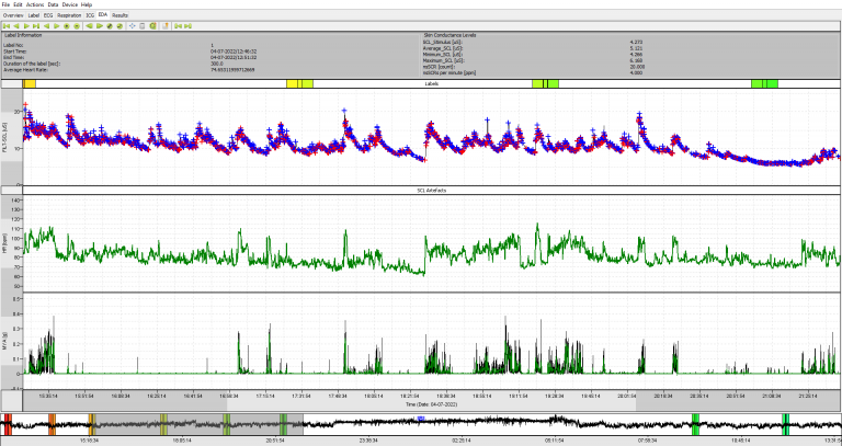 Electrodermal activity signals displayed in VU-DAMS analysis software